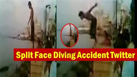 split face diving accident|split face dive full video.